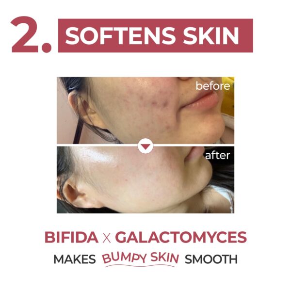 numbuzin No.3 Serum | Skin Softening Serum | Pores, Textured, Bumpy, Rough to Glass Skin | Bifida, Galactomyces, Niacinamide, Adenosine, Panthenol | 1.69 fl. oz. - Image 6