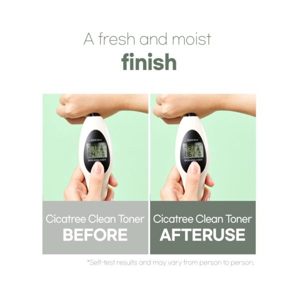 [Mixsoon] Cicatree Clean Toner 5.07 fl oz/150ml | Daily toner for troubled skin, fast absorption, zero irritation | Cruelty-free - Image 5