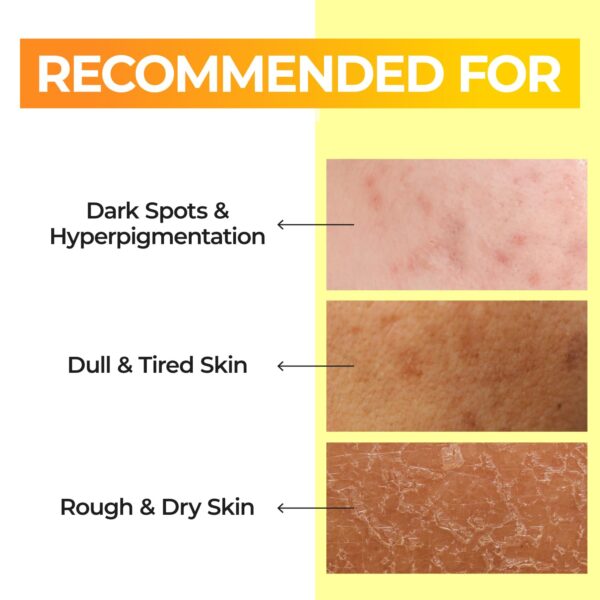numbuzin No.5 Toner | Vitamin Boosting Essential Toner | First Step Skin Care | Improves Hyperpigmentation and Uneven Skin Tone | 6.76 fl. oz. - Image 3