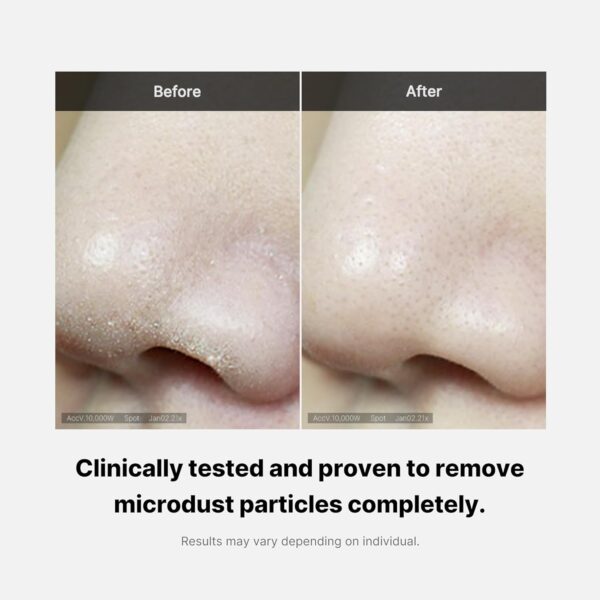 medicube Zero Foam Cleanser for Sensitive Skin - Sebum Control, Moisture Balance, and Pore Minimization | Korean Skincare - Image 5