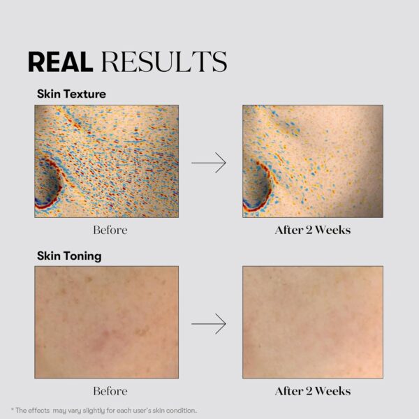 VT COSMETICS TX Toning Facial Toner with Tranexamic Acid, Niacinamide, Glutathione, Hydrating, Refreshing Toner for Dark Spots, Acne Scar, Exfoliating, Sensitive Skin, Korean Skincare, Fragrance-Free - Image 4