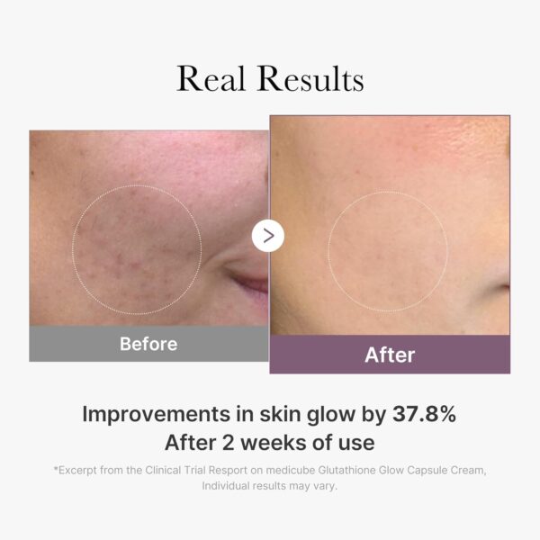 medicube AGE-R Glutathione Glow Capsule Facial Cream - Instant Lifting Moisturizer - Collagen Peptide For Hydrating Glow - Improve Blemishes, Uneven Skin Tone - Korean Skin Care 1.69 fl.oz - Image 5