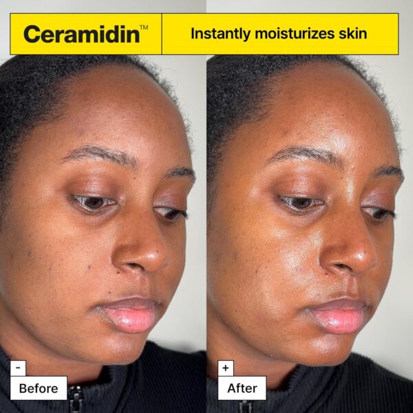 Dr.Jart+ Ceramidin™ Skin Barrier Moisturizer Face Cream For Dry Skin with Ceramides and Panthenol | Korean Skin Care - Image 5